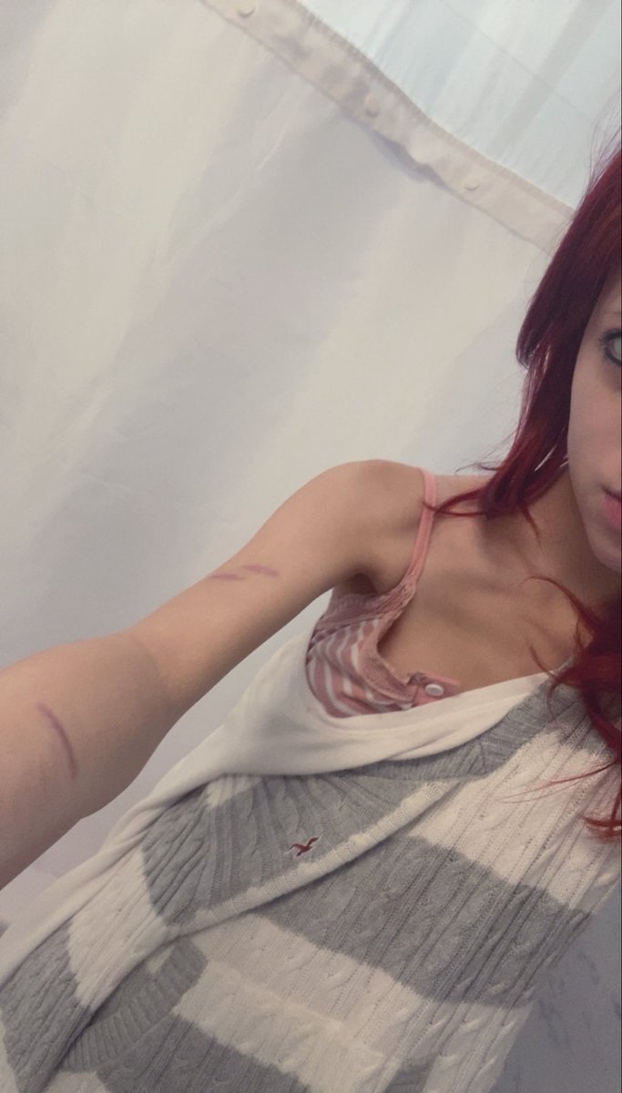 cupcakebunniie's tweet image. i miss being able to easily wrap my fingers around my upper arm :(
#edtwt #bodycheck #bc