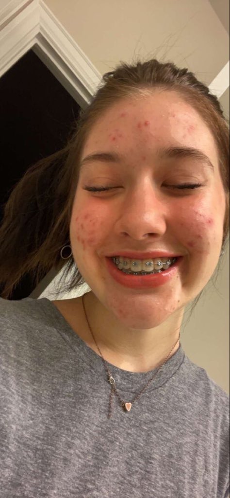 Emily 🍫 tweet media