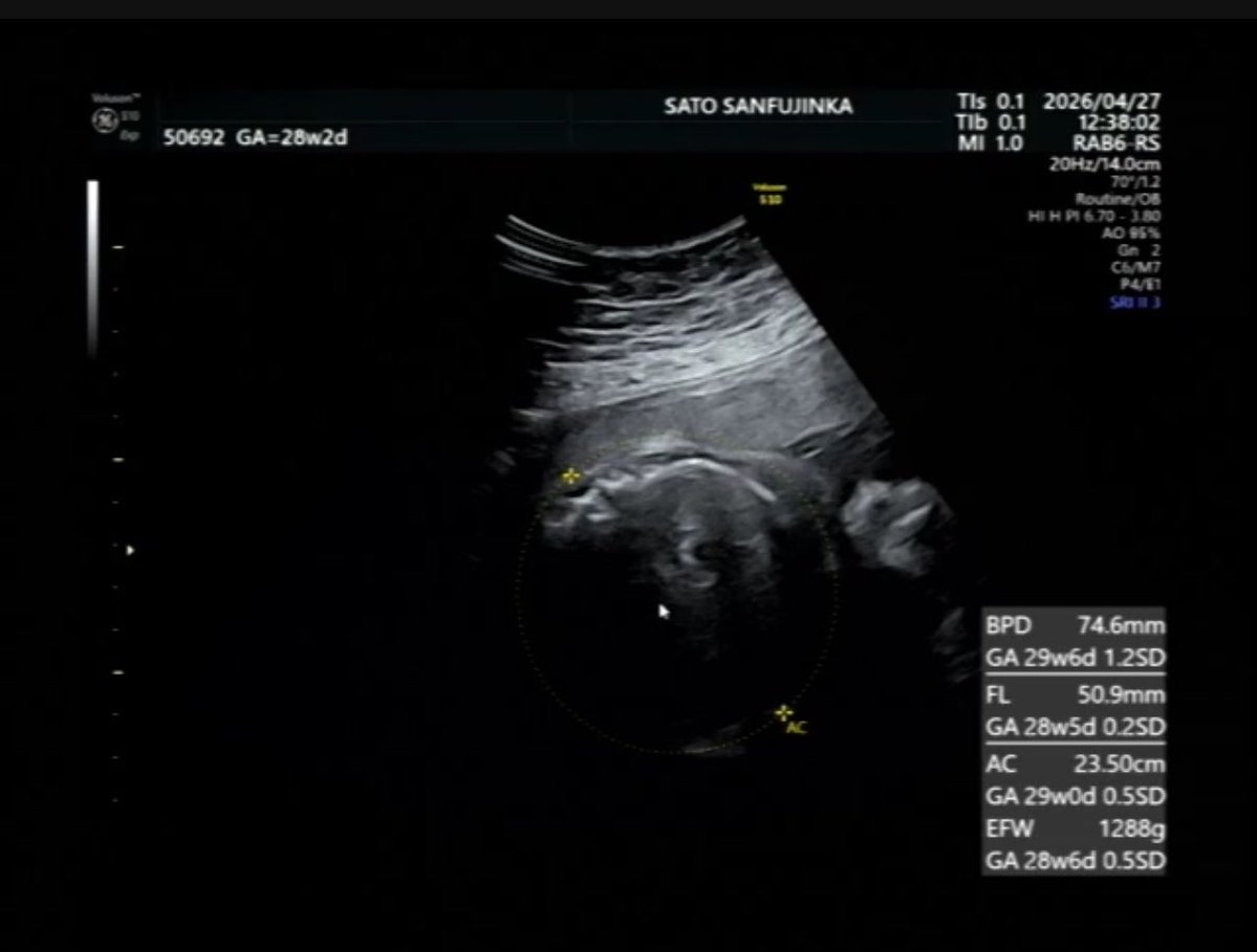 きむこ@初マタ28w tweet media