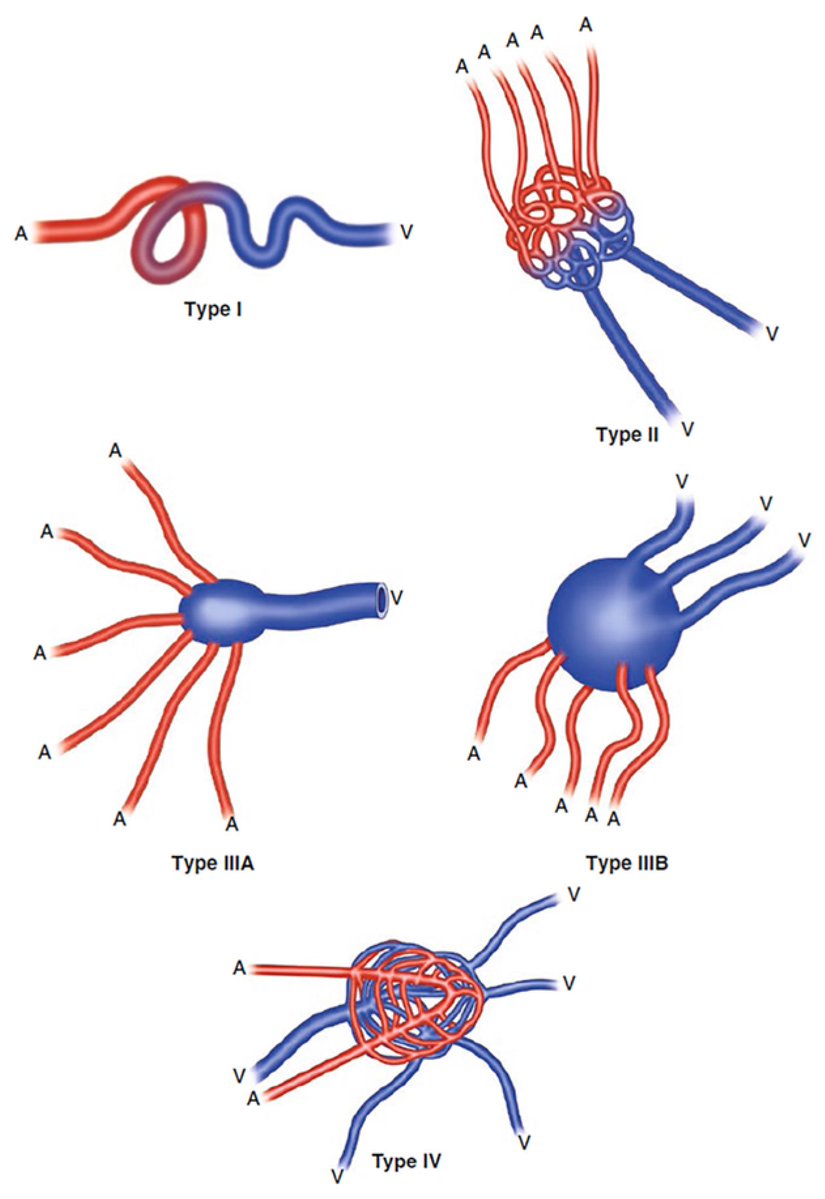 Children_MDPI's tweet image. Call for readings for our Highly Cited Paper in 2024👏
Title: Congenital Vascular Malformations in Children: From Historical Perspective to a Multidisciplinary Approach in the Modern Era—A Comprehensive Review
buff.ly/5BeRKSs
#CongenitalVascularMalformations #Children