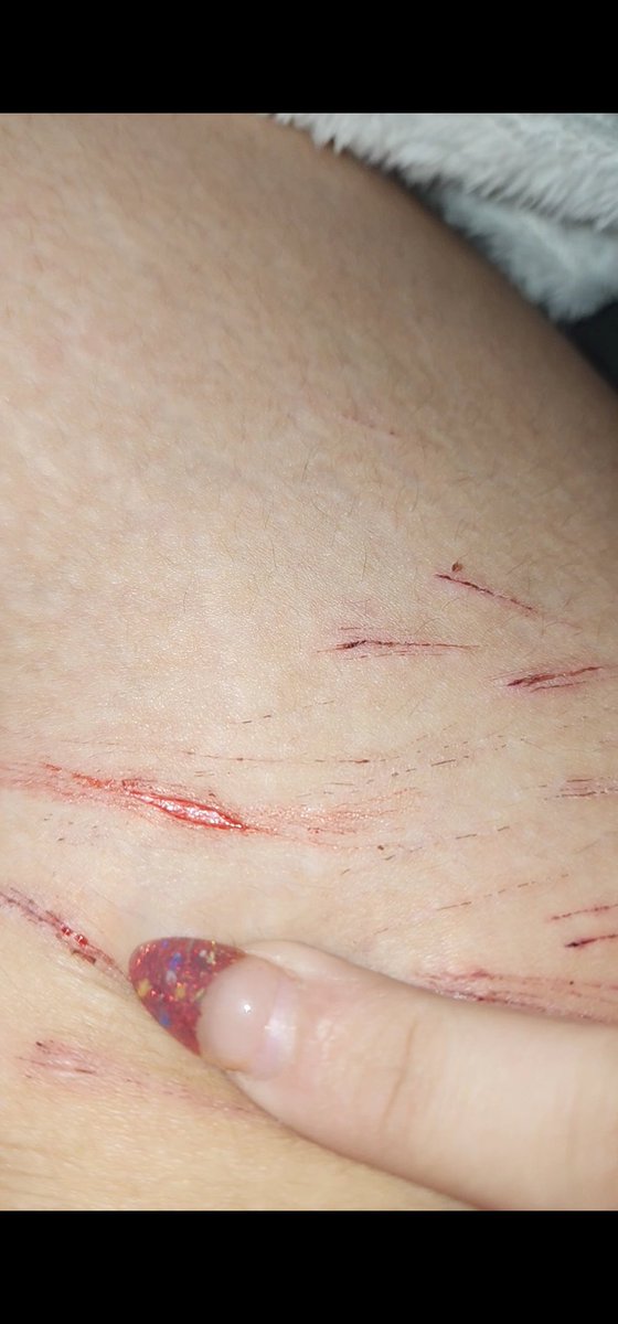 vivi (shedtwt) tweet media