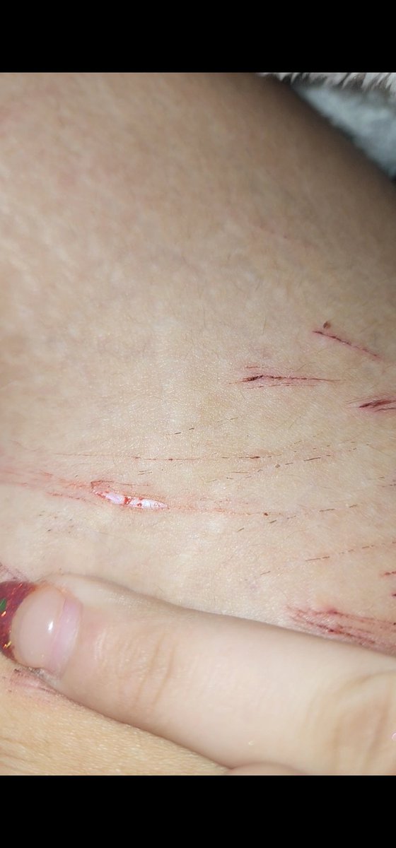 vivi (shedtwt) tweet media