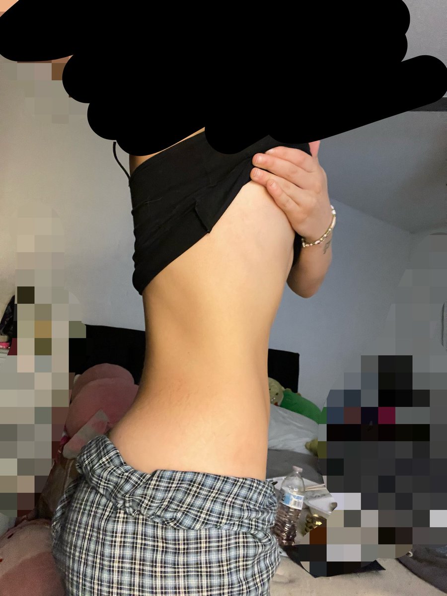 witchfairygirl's tweet image. My legs disgust me 

BMI20
#bodycheck #edtwt #embarrassing