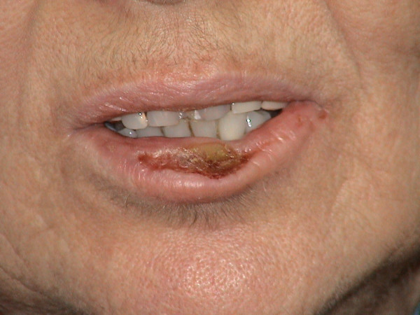 Яizal do tweet media