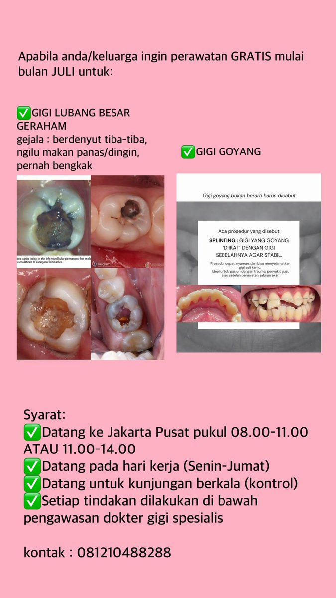 bratzdentz's tweet photo. Apabila anda ingin melakukan perawatan gigi TANPA pungutan biaya (semua biaya saya tanggung)👇 berikut syaratnya 

Kontak :
☎️https://t.co/TkVYHq8YiU

#sakitgigi #gigilubang #gigibungsu #gigigoyang  #tambalgigi #gigipalsu #scalinggratis #koasgigi #fkg #gratis #doktergigi https://t.co/ZWtVIKmw4F