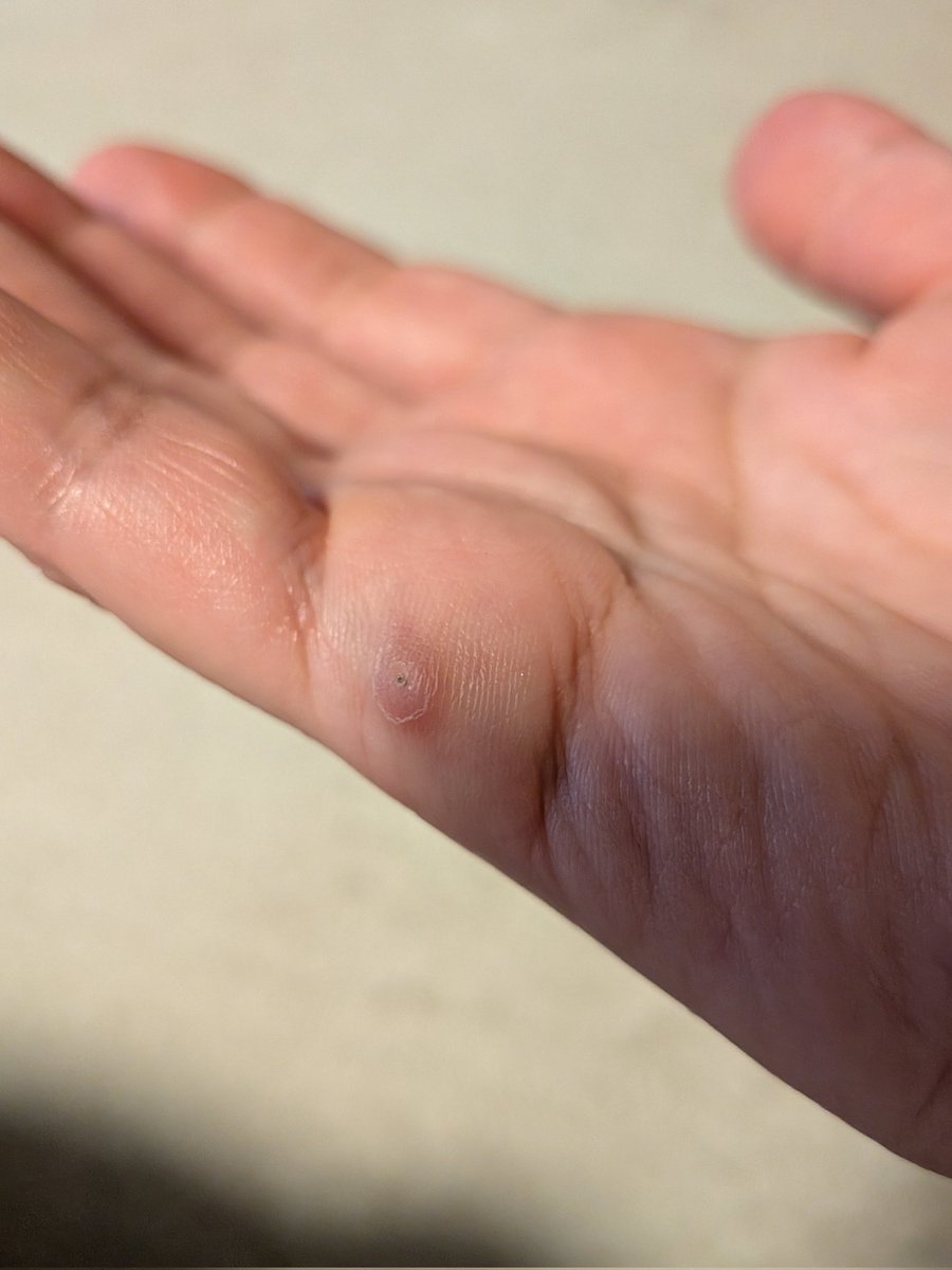 こころ(サブ垢） tweet media