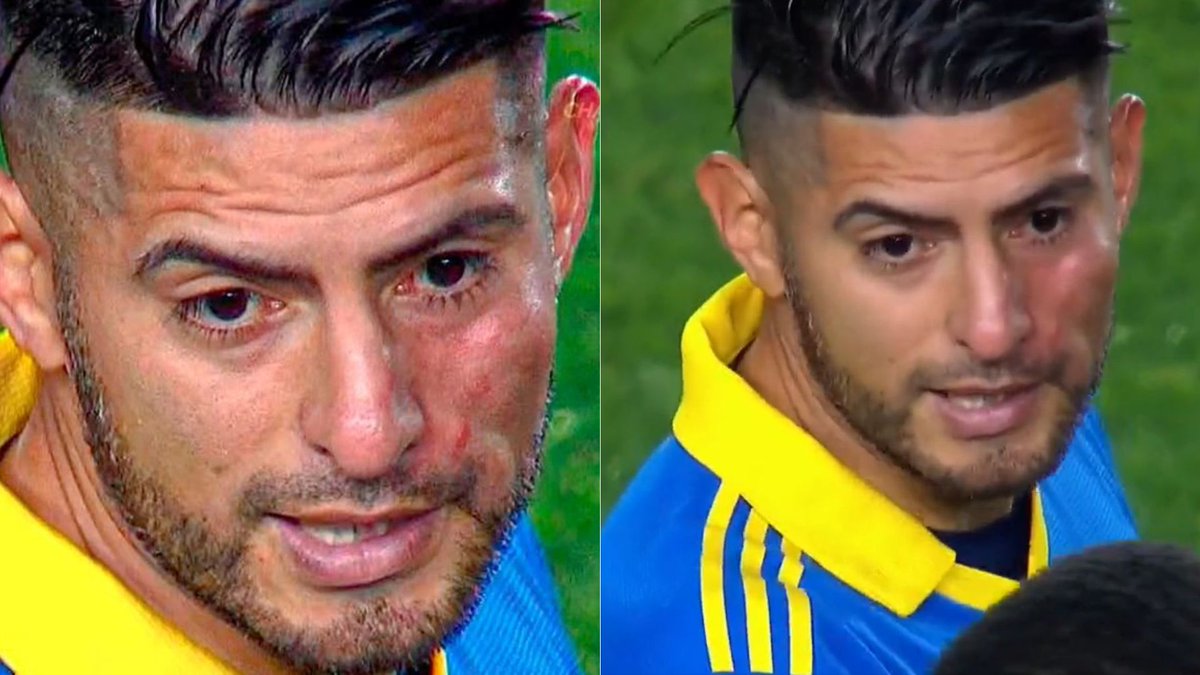 FBC2393's tweet photo. @la12tuittera Bareiro tiene que volver al pais con la cara asi por pelotudo.
Es increible que todavia no entiendan que se debe jugar con la cabeza cuando el arbitro ya te condiciona desde temprano. https://t.co/NU9kETPOJh