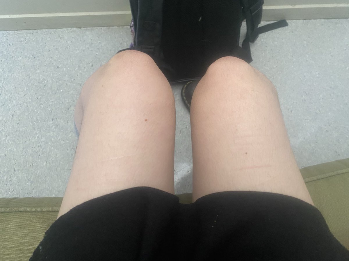 angie_babesxx's tweet image. bc but im at school 👀👀👀 and im fat #edtwt #bodycheck