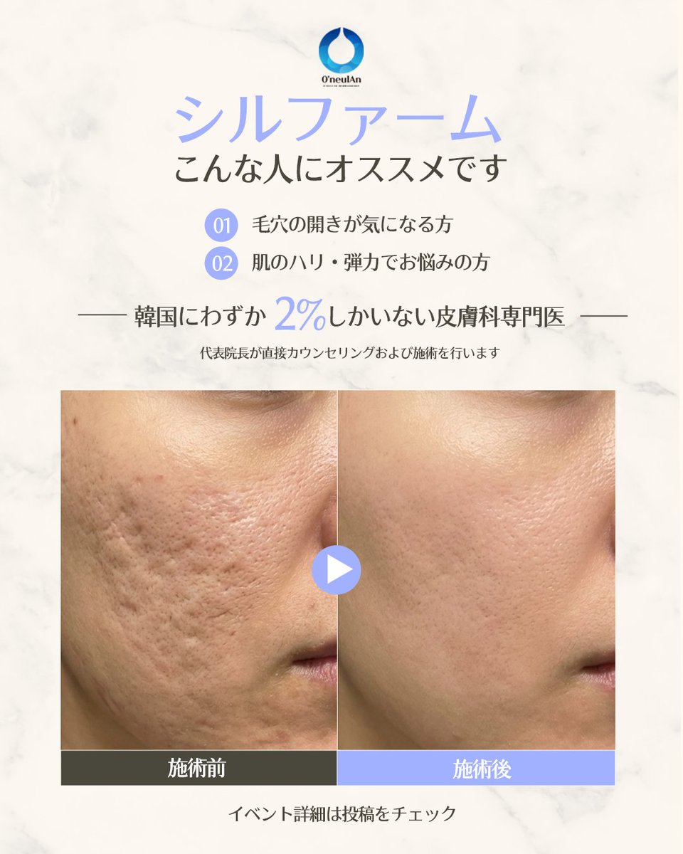 オヌルアン皮膚科【狎鴎亭】 tweet media