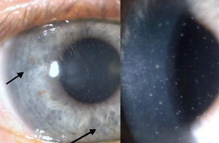 drgunjand's tweet image. Name the scientist.

#MedTwitter #ophthalmology 
Images from google