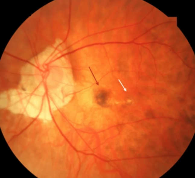drgunjand's tweet image. Name the scientist.

#MedTwitter #ophthalmology 
Images from google