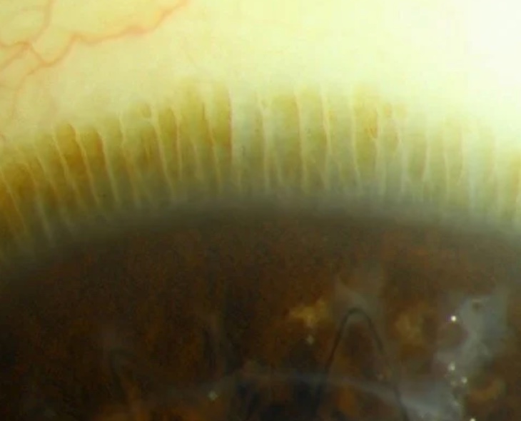 drgunjand's tweet image. Connect the images.

#MedTwitter #ophthalmology 
Images google