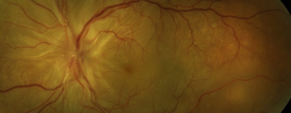 drgunjand's tweet image. Connect the images.

#MedTwitter #ophthalmology 
Images google