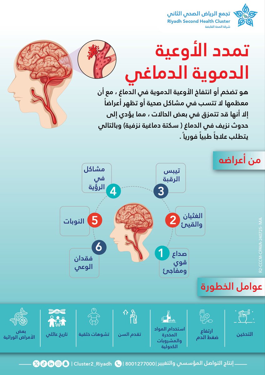 KFMC_RIYADH's tweet photo. تمدد الأوعية الدموية الدماغي ..تجاهل العلامات التحذيرية قد يفاقم الحالة 

#مدينة_الملك_فهد_الطبية
#تجمع_الرياض_الصحي_الثاني https://t.co/KGyEVpuIfc