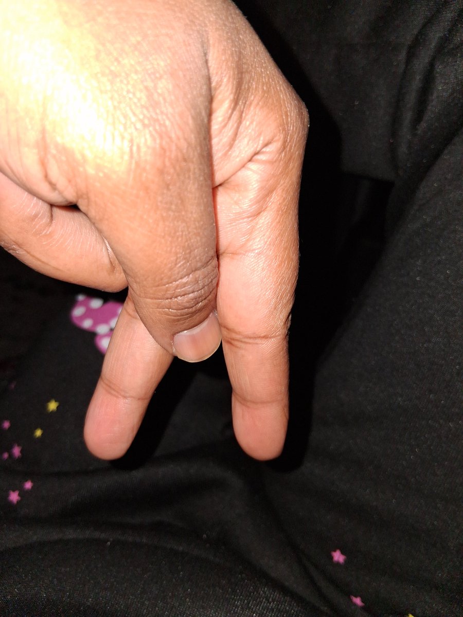 barcaboni10's tweet image. Wemby to Portland jews tonight.   #B2A @wemby @NBA @StephonCastle @Yvngdevo @espn @ESPNPR @ESPNNBA @CourtneyRCronin @EvCoRadio @peacock @PrimeVideo @NBAonPrime @NBAonNBC