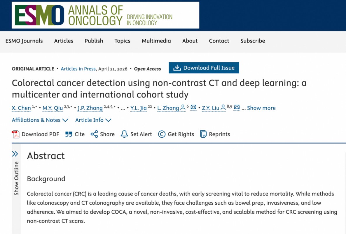 WIC_espanol's tweet image. 【🔬¡Alibaba lanza su tercer modelo de IA para cáncer: logros consecutivos en detección de cáncer de páncreas, estómago e intestino!】El Instituto DAMO de #Alibaba, en colaboración con el Hospital Provincial del Pueblo de Guangdong y otras instituciones, ha desarrollado el modelo
