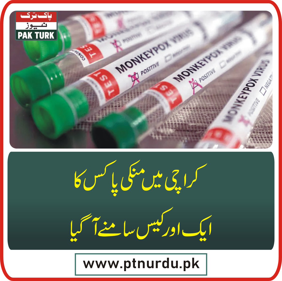 pakturknews's tweet photo. کراچی میں منکی پاکس کا ایک اور کیس سامنے آگیا
https://t.co/q85sMdyfLf
#monkeypoxx #health #karachi https://t.co/PhNKGA6M5P
