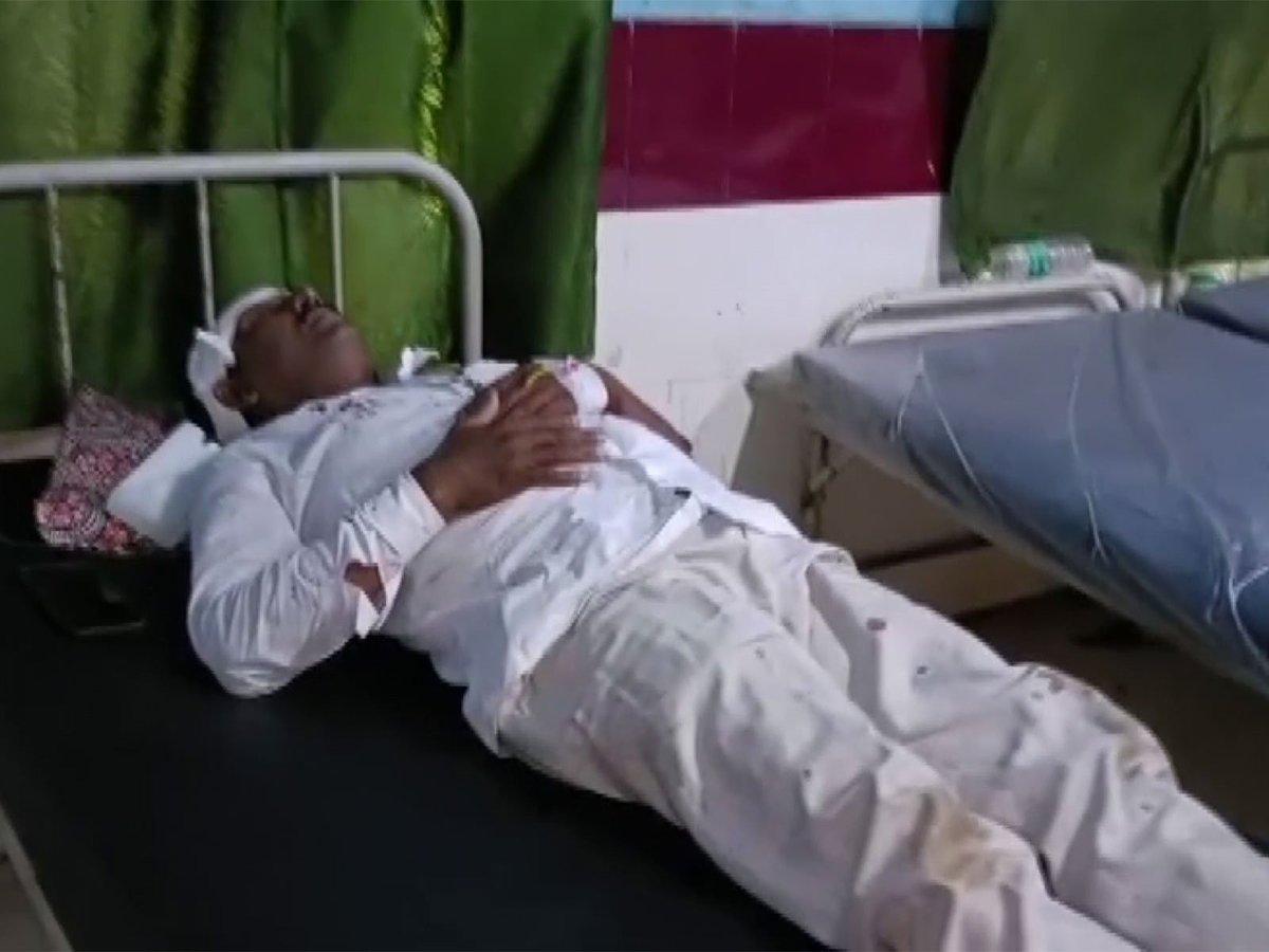 ani_digital's tweet image. WB polls: BJP polling agent allegedly attacked in Nadia's Chapra Assembly constituency

Read @ANI Story | aninews.in/news/national/…

#TMC #BJP #Polls #WestBengal