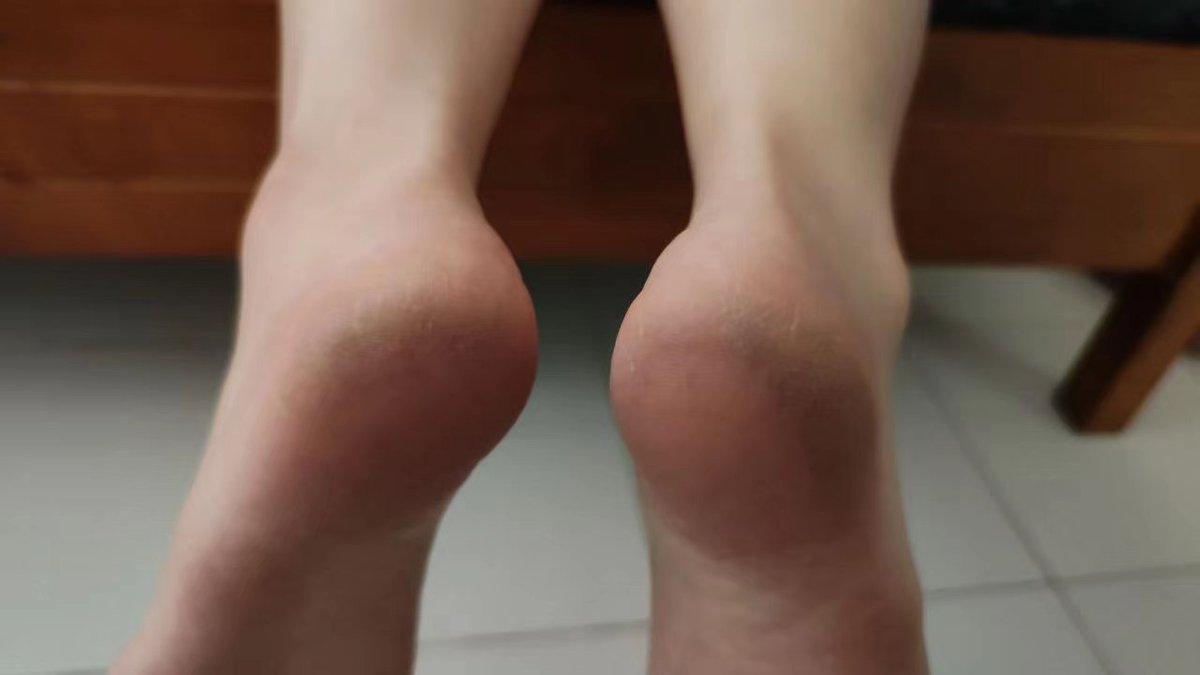 EeKloi's tweet photo. My massage includee foot scrub which remove dry skin at feet. I will lick and suck feet and toe when massage feet.

#Footfetish https://t.co/QKE9SjFANk