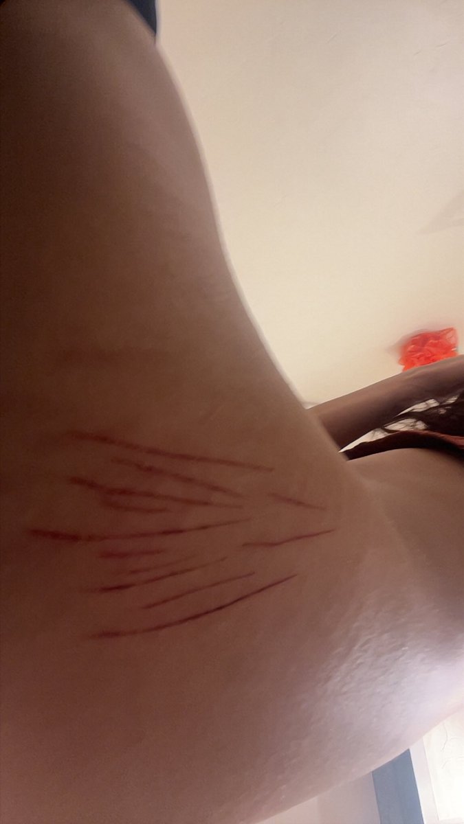 Gh0st3ys's tweet photo. Recent relapse 🐾🪶 
They aren’t to bad, wanted to get ones like my other scars but we ball ig. https://t.co/vIVjUbeaKO