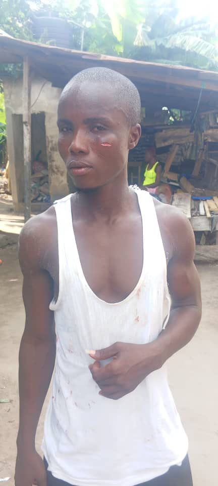 amglory8's tweet photo. ATTENTION: Hon. Chief Augustine Ogedegbe JP, Executive Chairman of Ethiope East LGA 
Please inform your boys that torture is a crime against humanity.
These pictures show the recent result of torture by your community vigilante members you inserted recently. https://t.co/T8fFjltzhQ