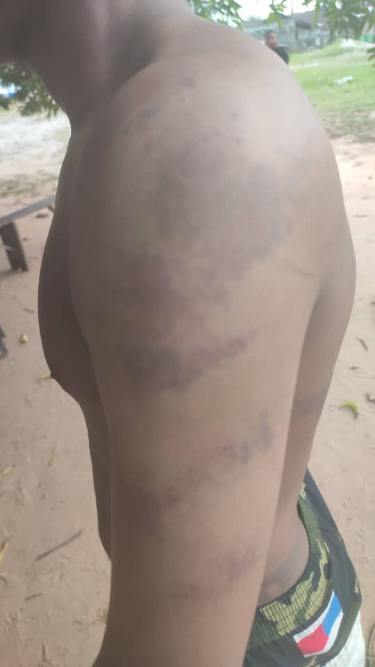 amglory8's tweet photo. ATTENTION: Hon. Chief Augustine Ogedegbe JP, Executive Chairman of Ethiope East LGA 
Please inform your boys that torture is a crime against humanity.
These pictures show the recent result of torture by your community vigilante members you inserted recently. https://t.co/T8fFjltzhQ