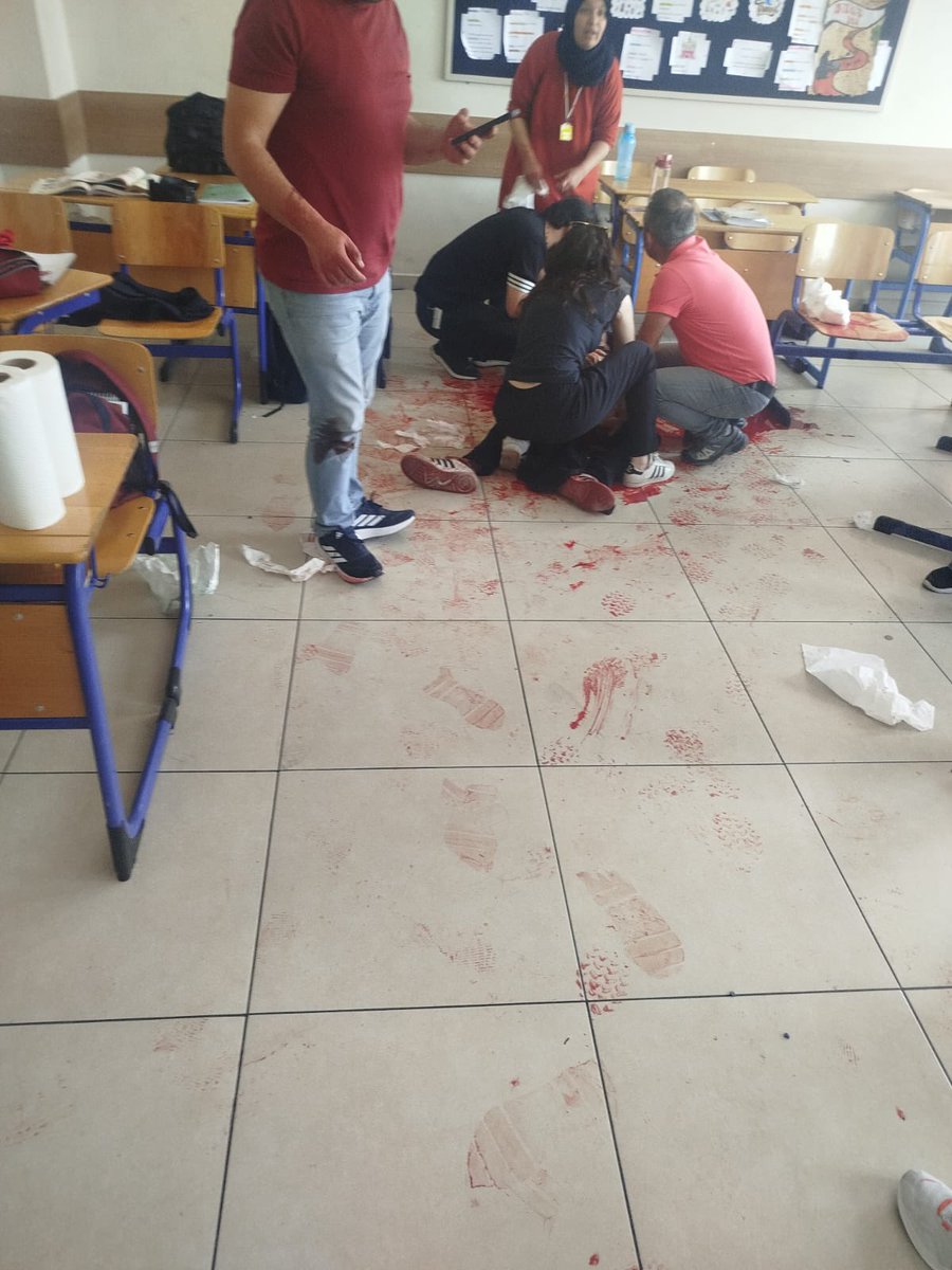 Yldrmbrcn_'s tweet photo. Milli Eğitim Bakanı “ Kahramanmaraş ve Şanlıurfa’da ki okul katliamında ne demişti; ( bazı karanlık yapılar” bizleri yani halkı suçlamıştı. Bu adamın bakanlığı döneminde işçi öğrenci ve okullarda toplam 40 çocuk hayatını kaybetti.

Potansiyel katillerin okulda ne işi var❓

Aman Tanrım, insanın kanı donuyor❗️❗️❗️

Bu ülkede bir evladımızın ayağına taş değse bizim içimiz yanıyor, KAHROLUYORUZ❗️❗️❗️ 

Osman Yüksel Serdengeçti İmam Hatip Ortaokulu'nda, ders saatinin ortasında Umut Tepecik isimli yavrumuz sınıfın içinde BIÇAKLANARAK ağır yaralanıyor❗️❗️❗️

Sol bacağından aldığı darbeyle hayata tutunmaya çalışan Umut’un feryadı vicdanları dağlarken, olayın ardından yaşanan skandallar PES dedirtti.

Baba Onur Tepecik, evladının kanı yerdeyken "hızlı ellerin" devreye girip olayı örtbas ettiğini, nüfuzlu tanıdıklar aracılığıyla gerçeklerin karanlığa gömüldüğünü haykırıyor.

Adaletin sadece duvardaki bir yazı değil, herkesin hakkı olduğunu kimse unutmasın. Bir çocuğun yaşama sevincini çalanların ve bu vahşeti gizlemeye cüret eden sorumluların peşini tabi ki bırakmayacağız. Nüfuzlu tanıdıklar değil, ilahi adalet tecelli edene kadar susmayacak; Umut için, çocuklarımız için adalet isteyeceğiz!

#Adaletİstiyoruz #ÇocuklarımızaDokunma #umuticinadalet @YMinguzzi78568 @adalet_bakanlik 
https://t.co/3bBvP8HwsV