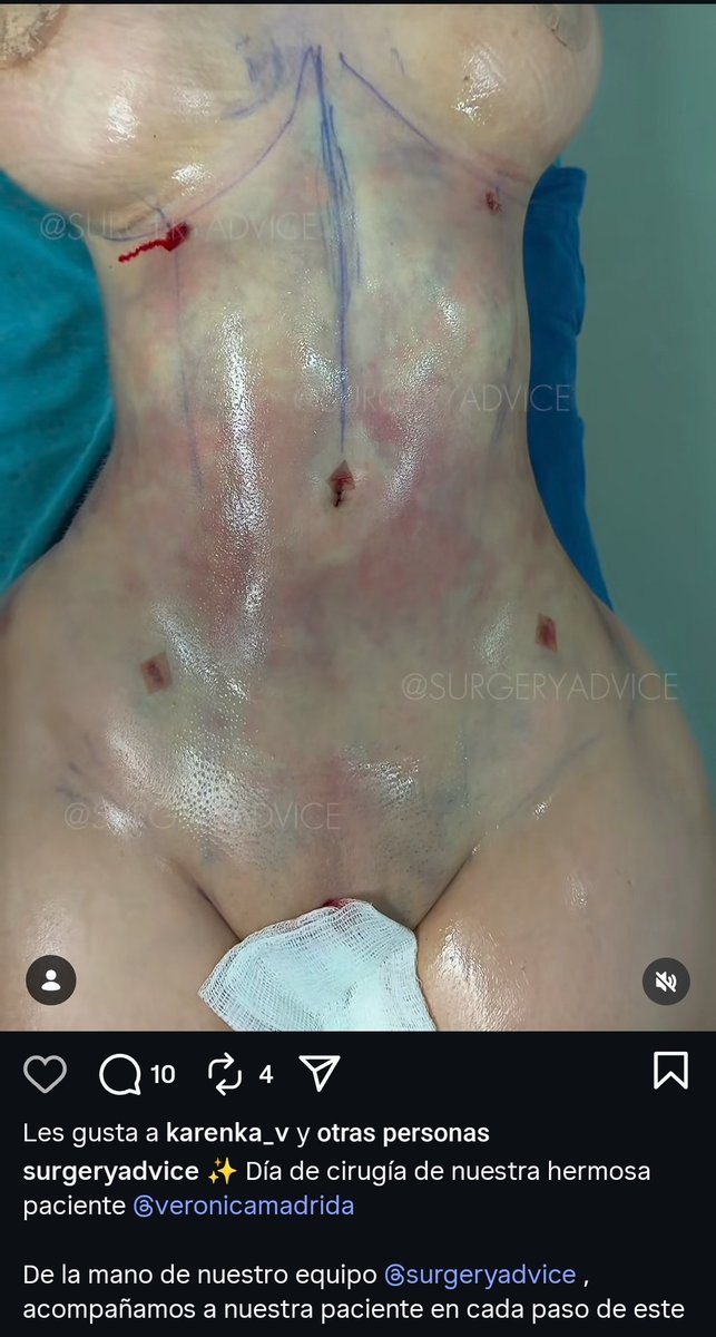 IIIIIIIIII- tweet media