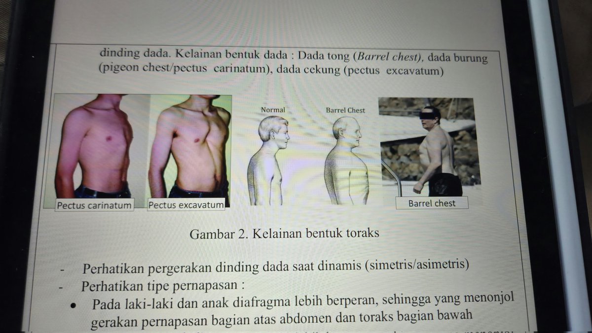 Kek kenal...