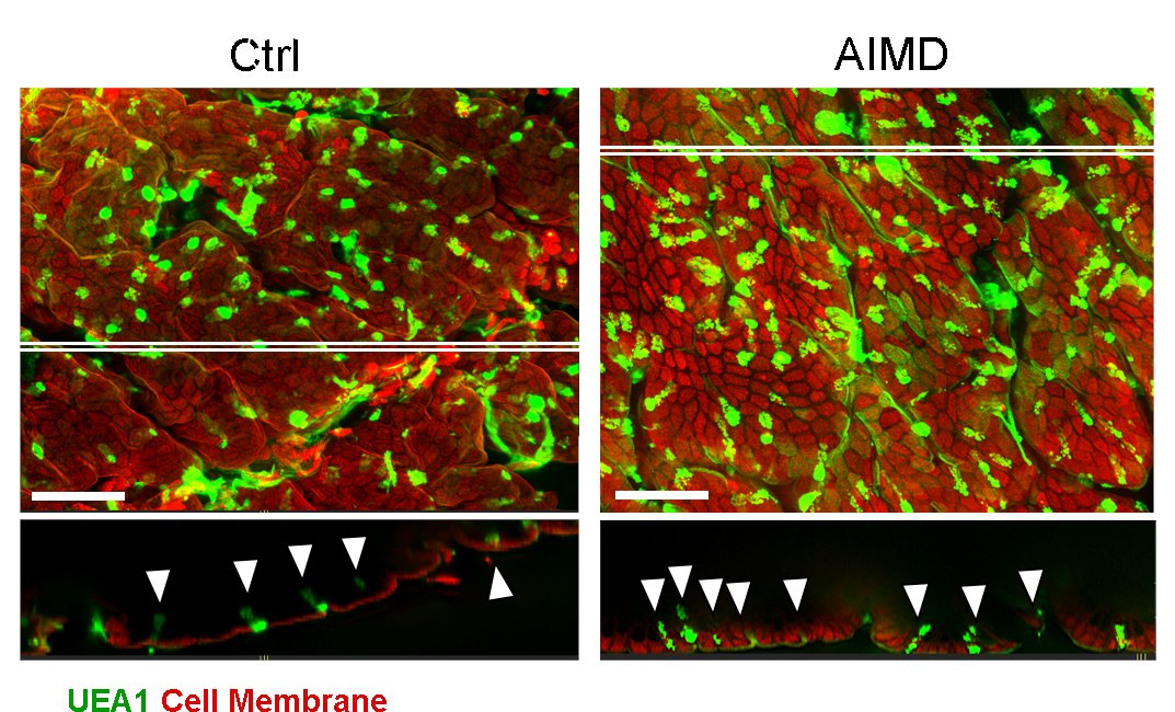 talius's tweet image. #Loss of #microbiota #alters the #profile of #cells that #protect the #intestinal #wall, experiments reveal  

The study shows microbiota and butyrate help gut lining cells produce mucus. This strengthens the intestinal barrier... scitechupdates.com/loss-of-microb…