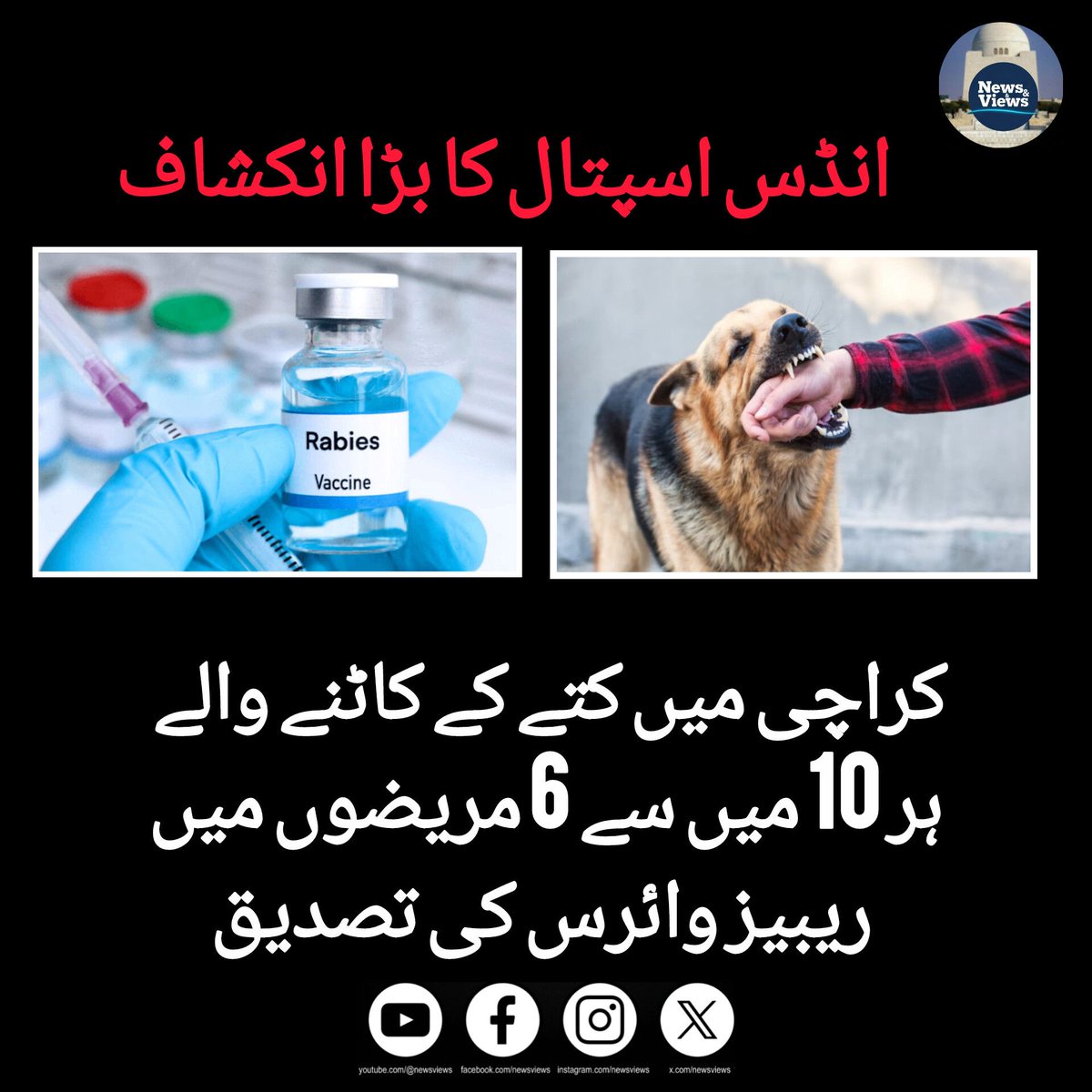 SaadMehmoo42823's tweet image. انڈس اسپتال کے  انتہائی تشویشناک انکشافات 

تحقیق کے دوران کتے کے کاٹے کا شکار ہونے والے 100 مریضوں کے زخموں میں ریبیز وائرس کی موجودگی کا معائنہ کیا گیا۔

ماہرین کے مطابق ہر 10 میں سے 6 مریضوں کے زخموں میں وائرس پایا گیا.

#rabbies #dogbites #straydogs #karachi