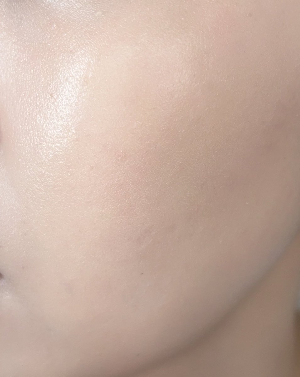 春谷(はるたに)｜イエベ春脂性肌の美容 tweet media