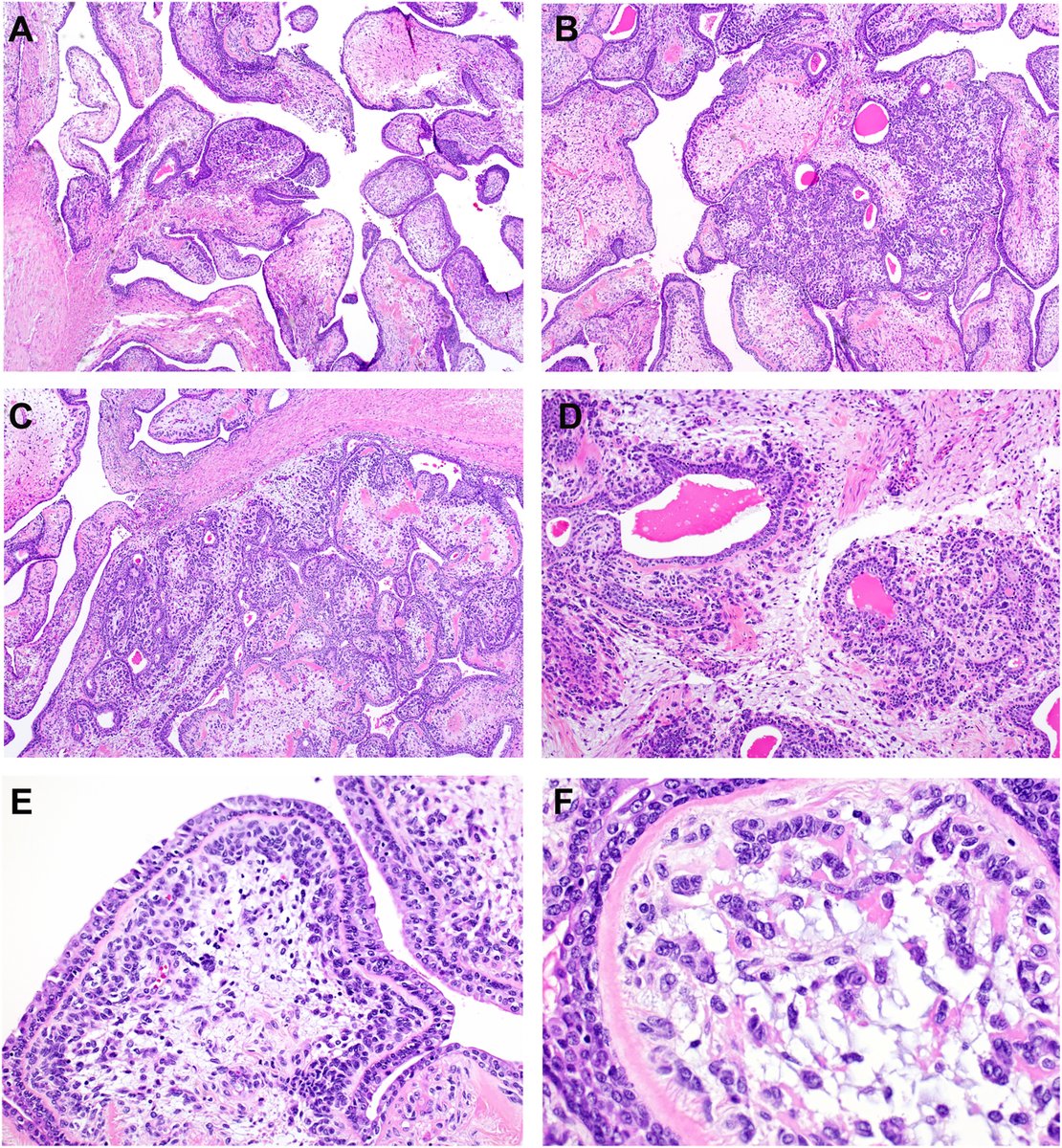 Human Pathology tweet media