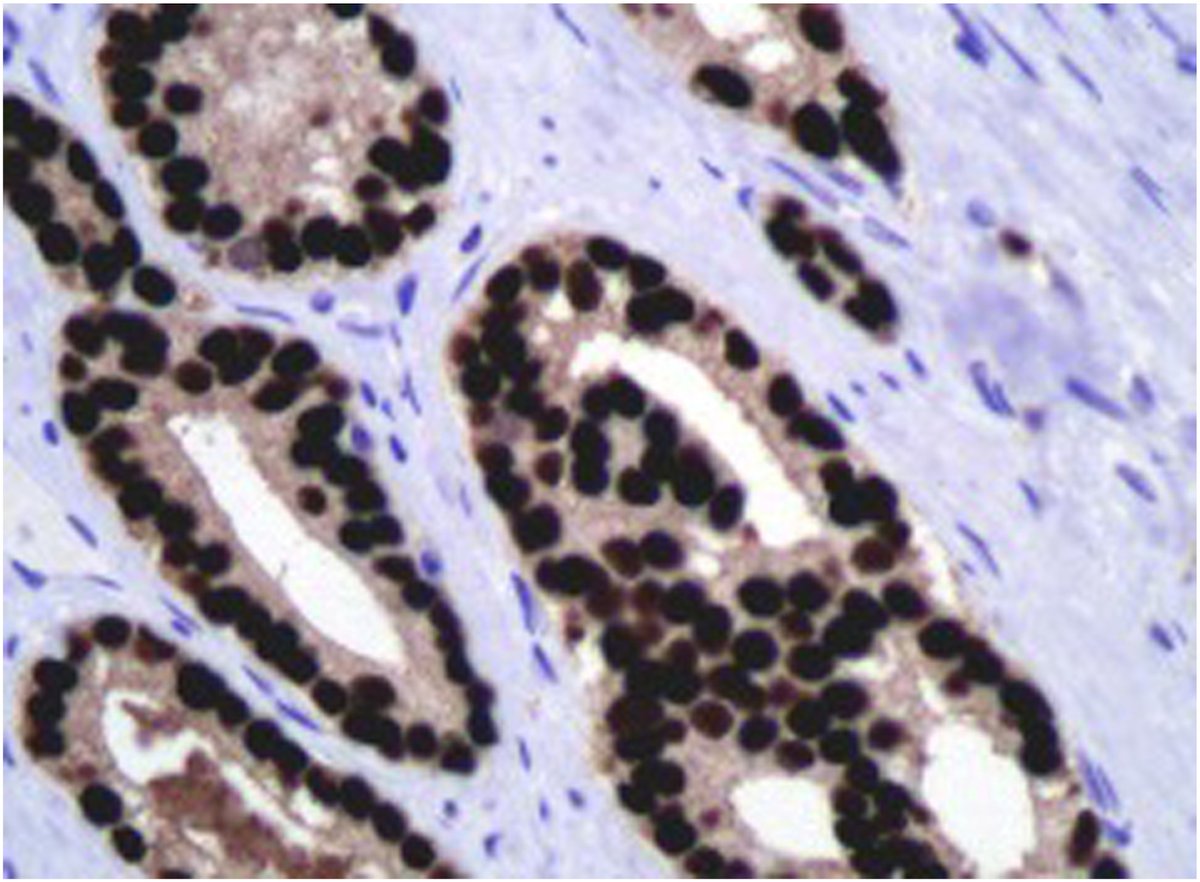Human Pathology tweet media
