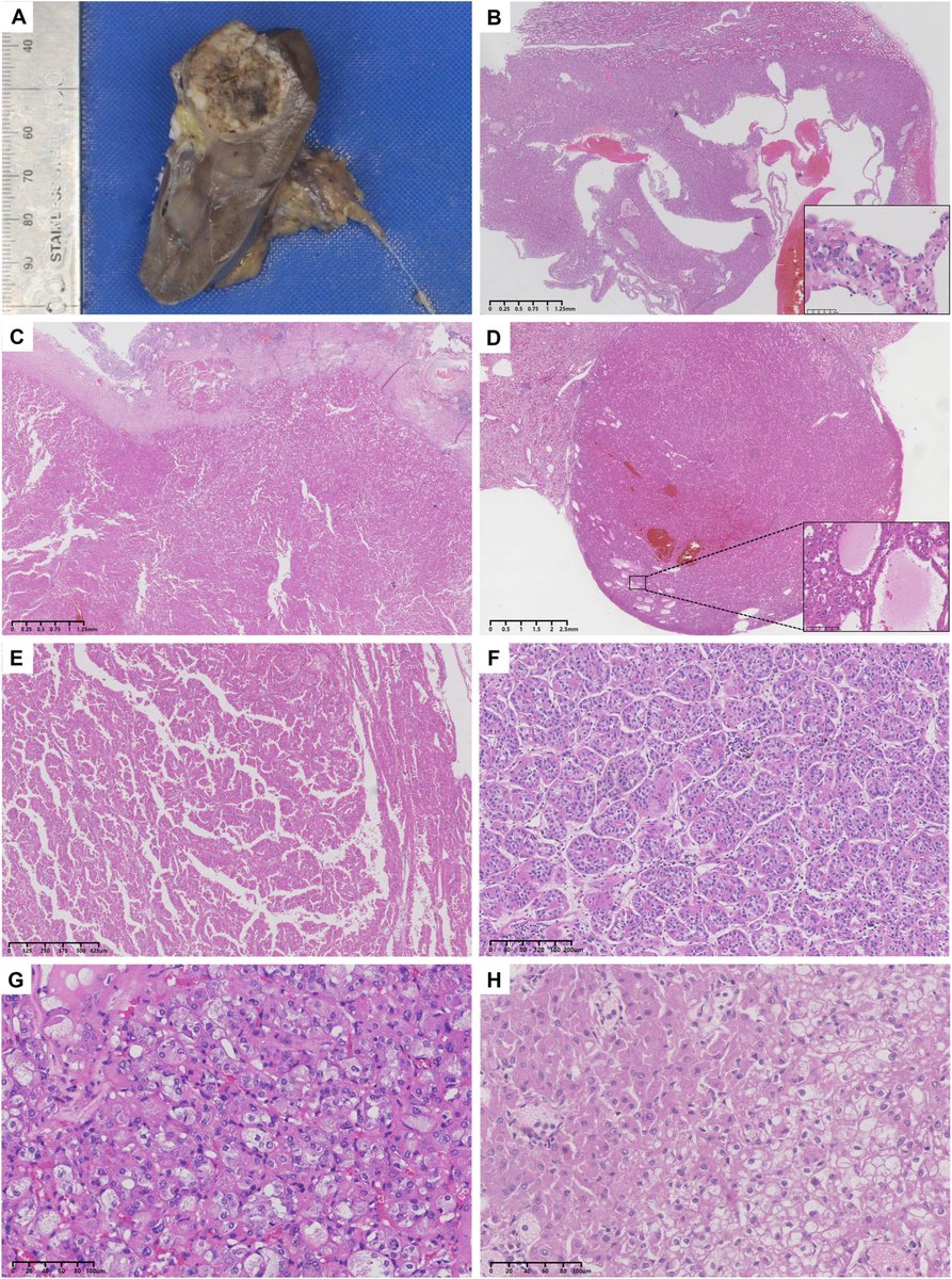 Human Pathology tweet media