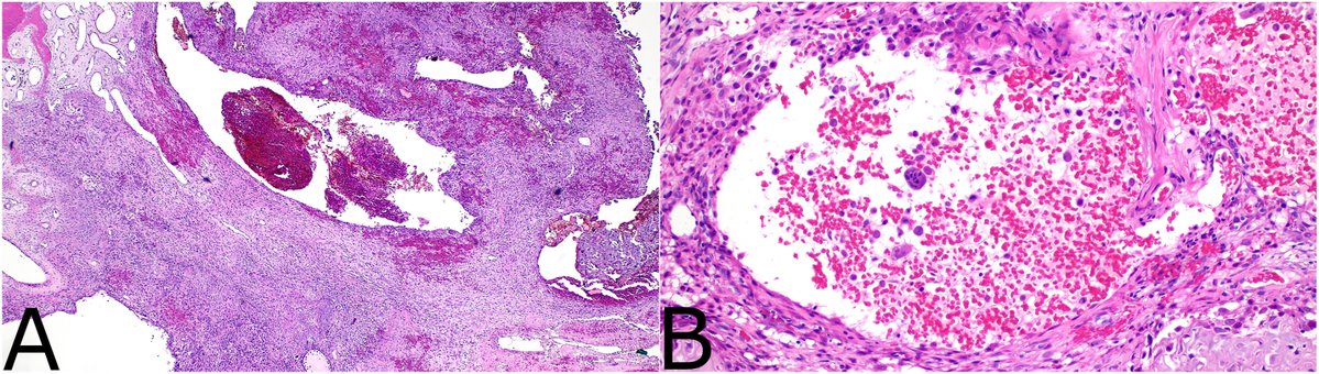 Human Pathology tweet media
