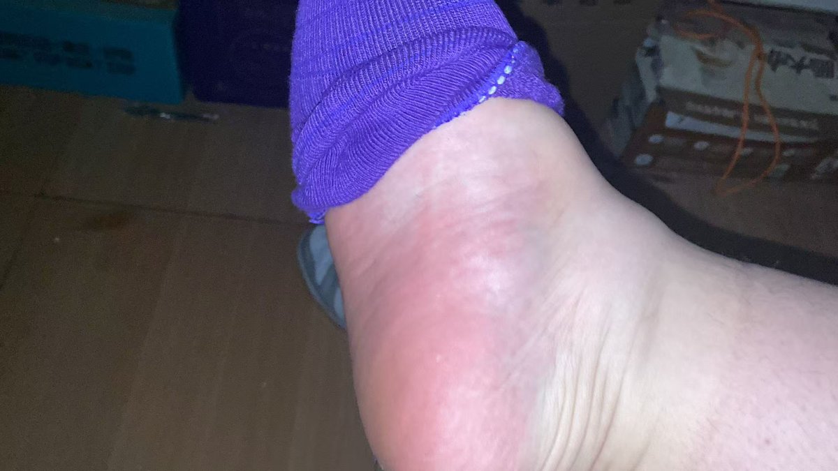 47码大肉脚 tweet media