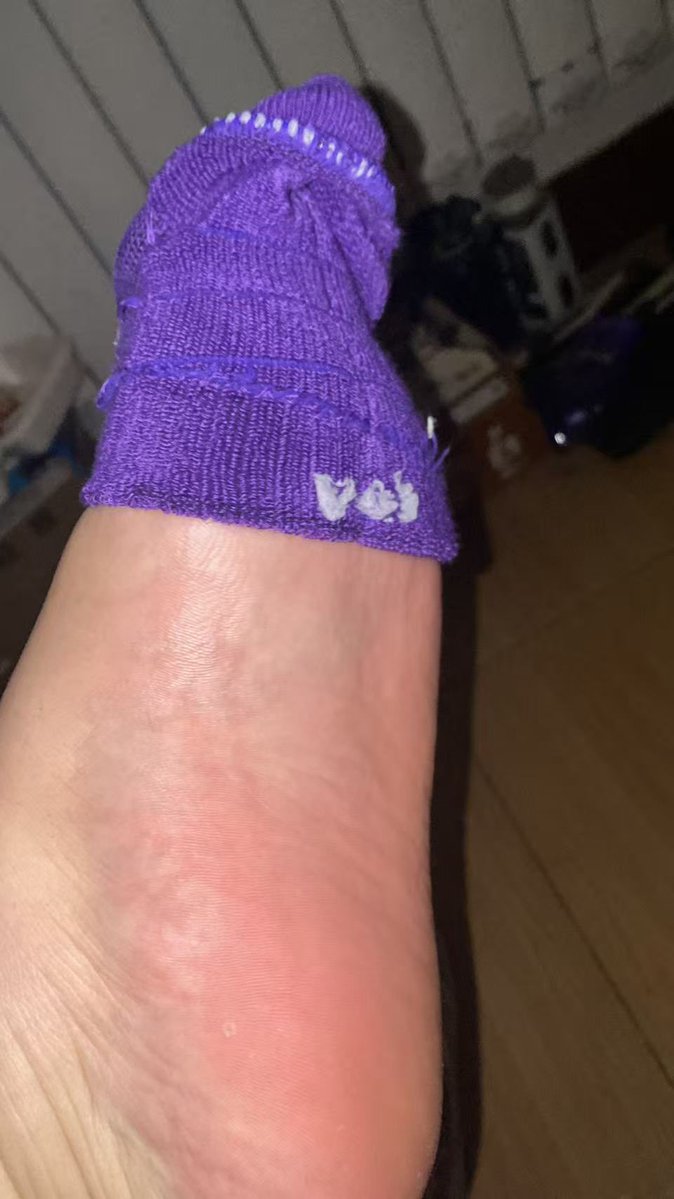 47码大肉脚 tweet media