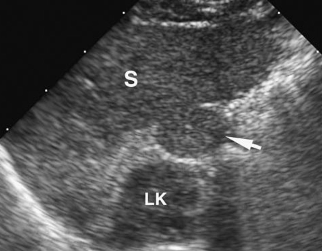 RadiographyNG☢️ tweet media
