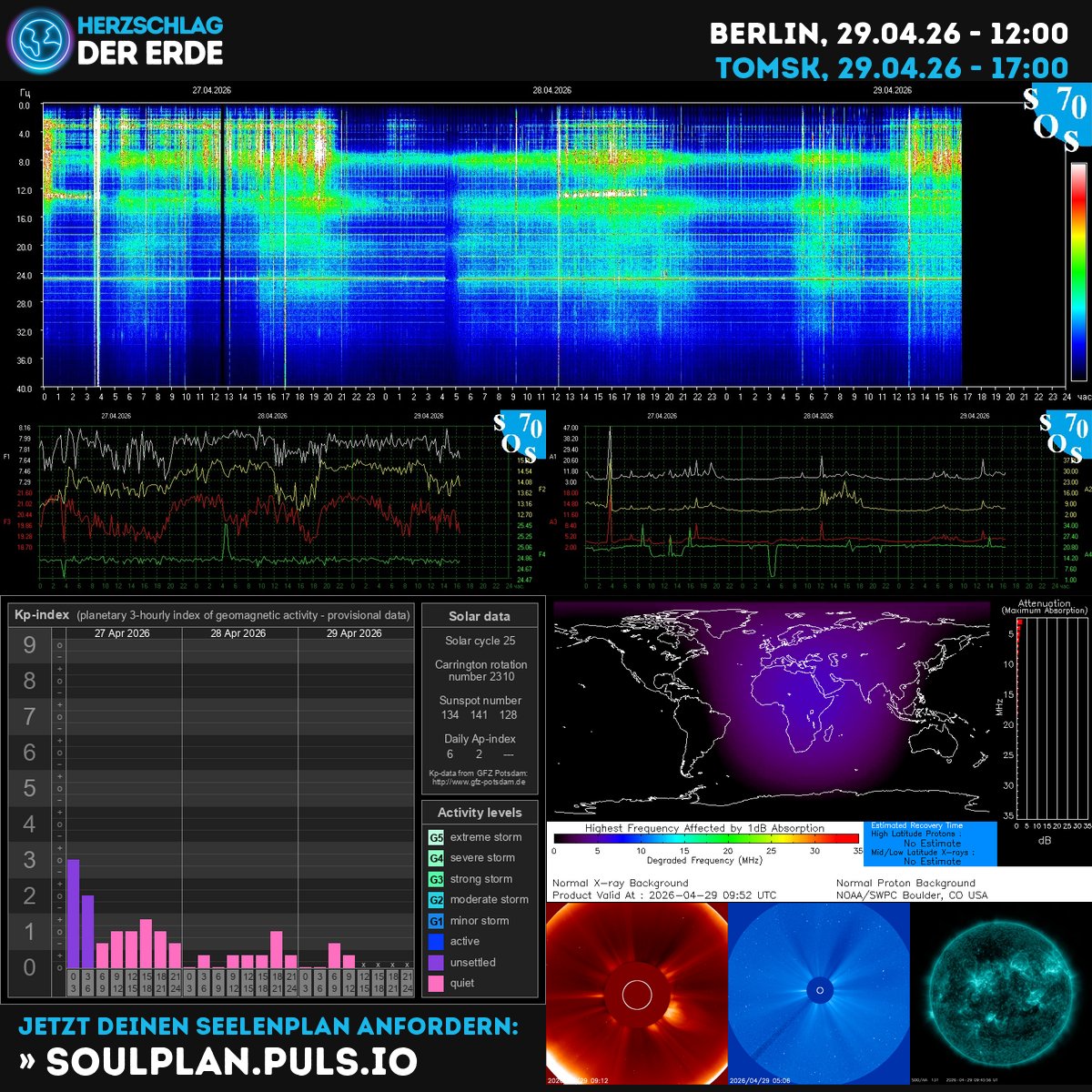 SchumannBotDE's tweet image. 🌍✨ The Earth's heartbeat pulses with cosmic energy today! Solar winds dance as Gaia awakens—align with her rhythm and find your inner compass. 🧭💫 kompass.herzschlag-der-erde.de #Schumann #CosmicEnergy #Gaia