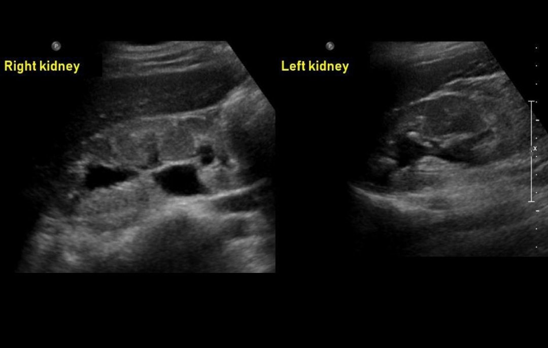 RadiographyNG☢️ tweet media