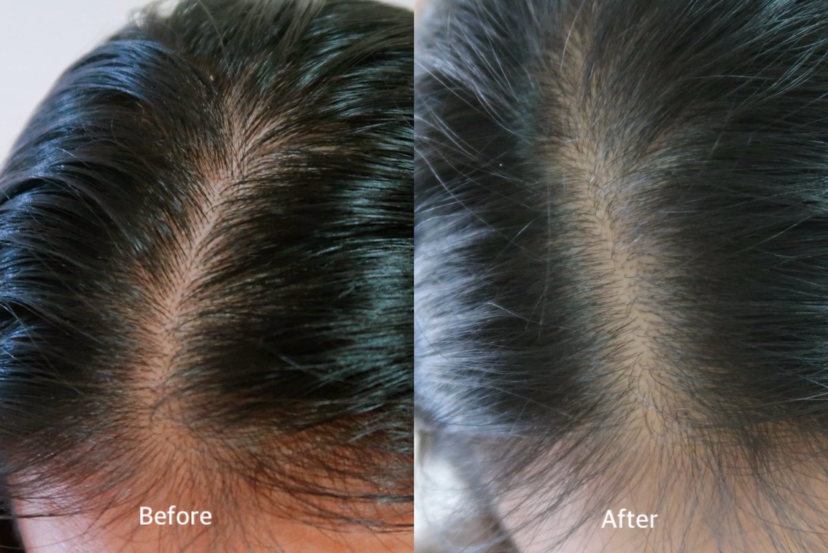 อะดิ๋วอิ๋วเอง🌷💫🌿 tweet media