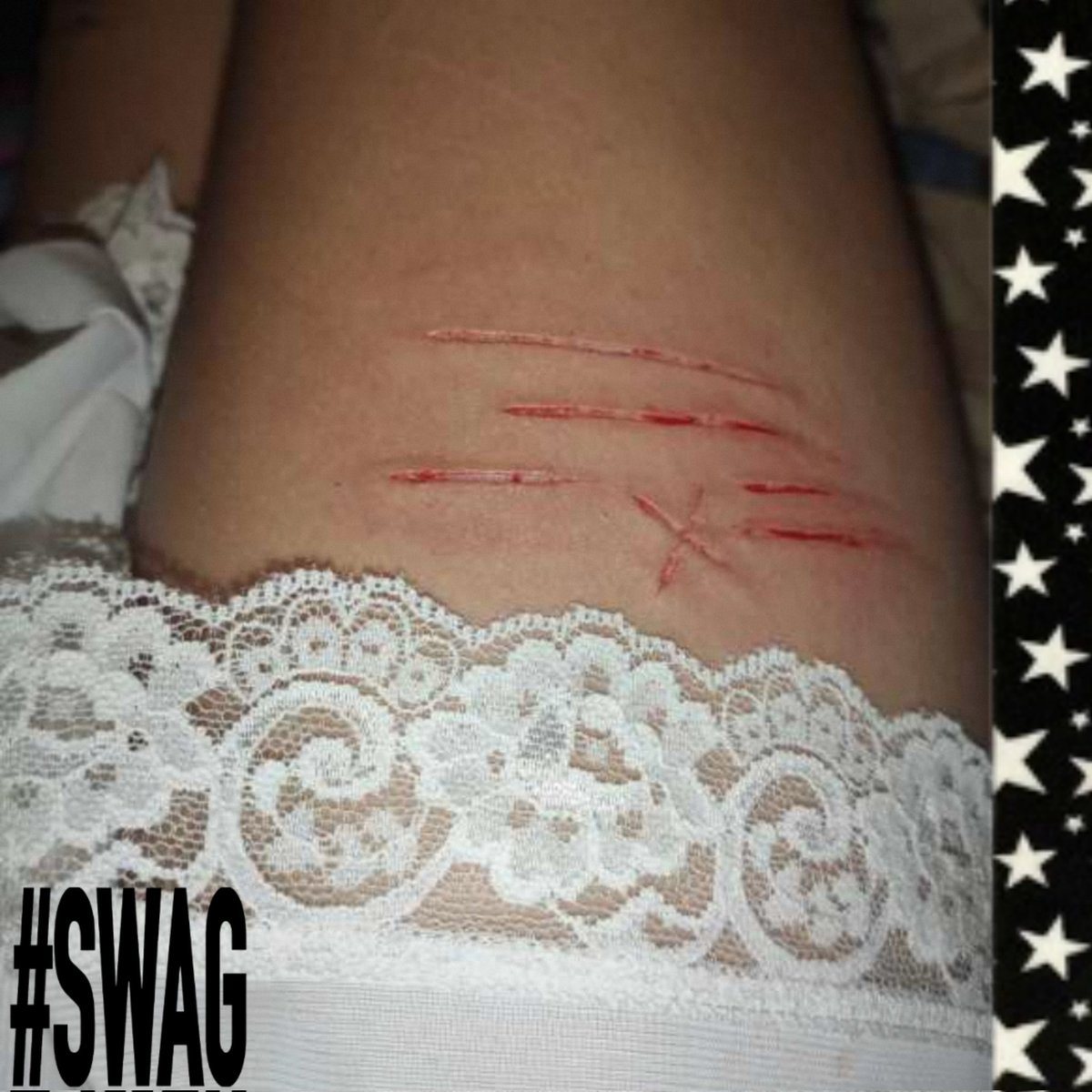 𝕱𝖗𝖆𝖓𝖐𝖞 tweet media