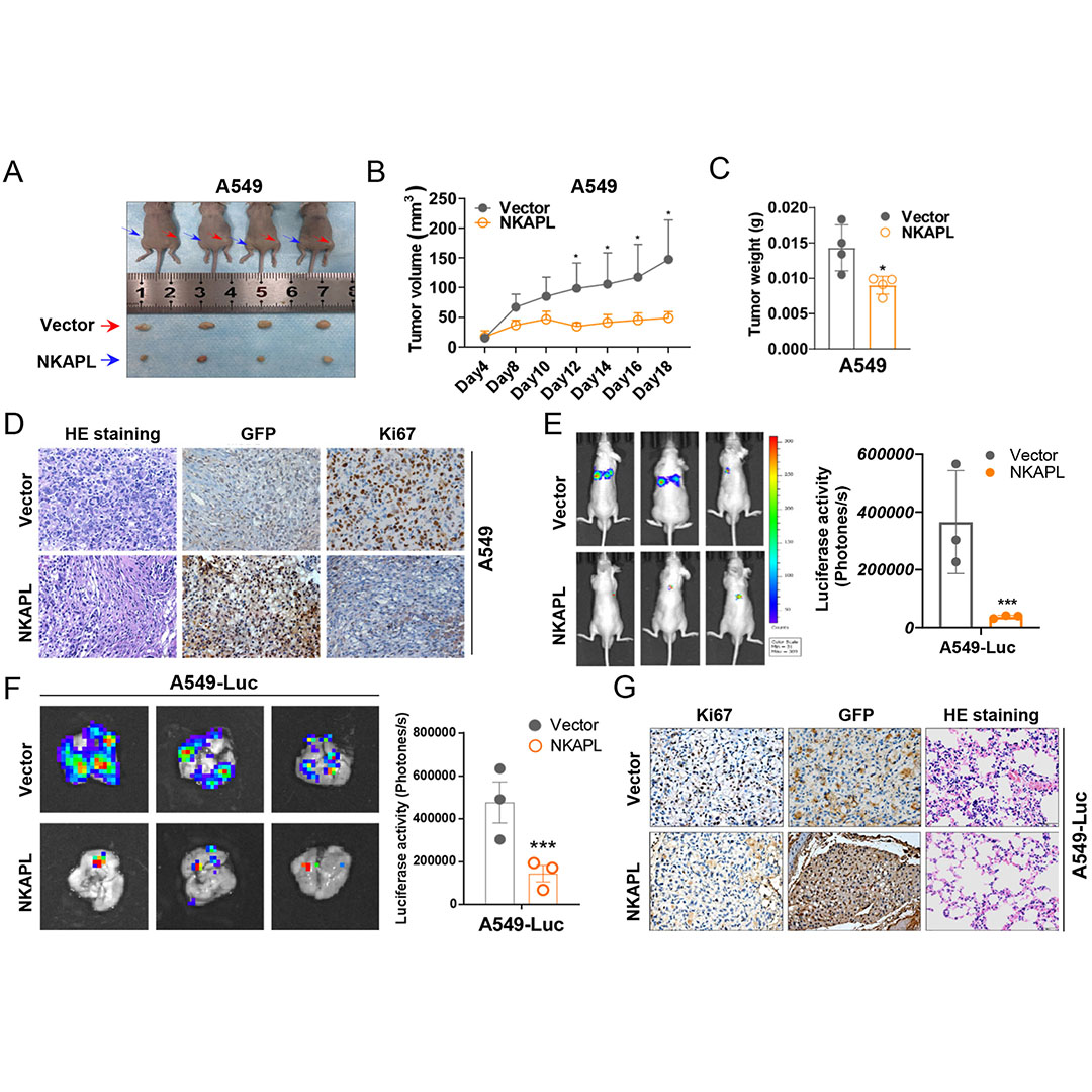 GenesNDiseases's tweet image. Promoter methylation downregulates #NKAPL in #NSCLC, and its restoration suppresses proliferation and #metastasis by stabilizing #TRIM21 and inhibiting #NFκBsignaling, highlighting NKAPL as a prognostic #biomarker and therapeutic target.
#OpenAccess: doi.org/10.1016/j.gend…