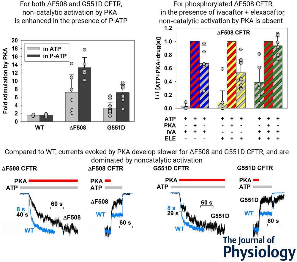 JPhysiol's tweet image. Olivér Závoti, Márton A. Simon &amp;amp; László Csanády (@semmelweishu) investigated altered functional interactions between #CFTR disease mutants ΔF508 and G551D and the #protein kinase A catalytic subunit 🔬 📜 

Read the study here: 
🔗 buff.ly/b4A2mrs