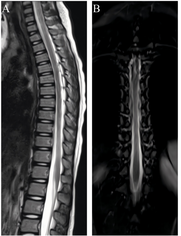 Spinal Cord Journal tweet media