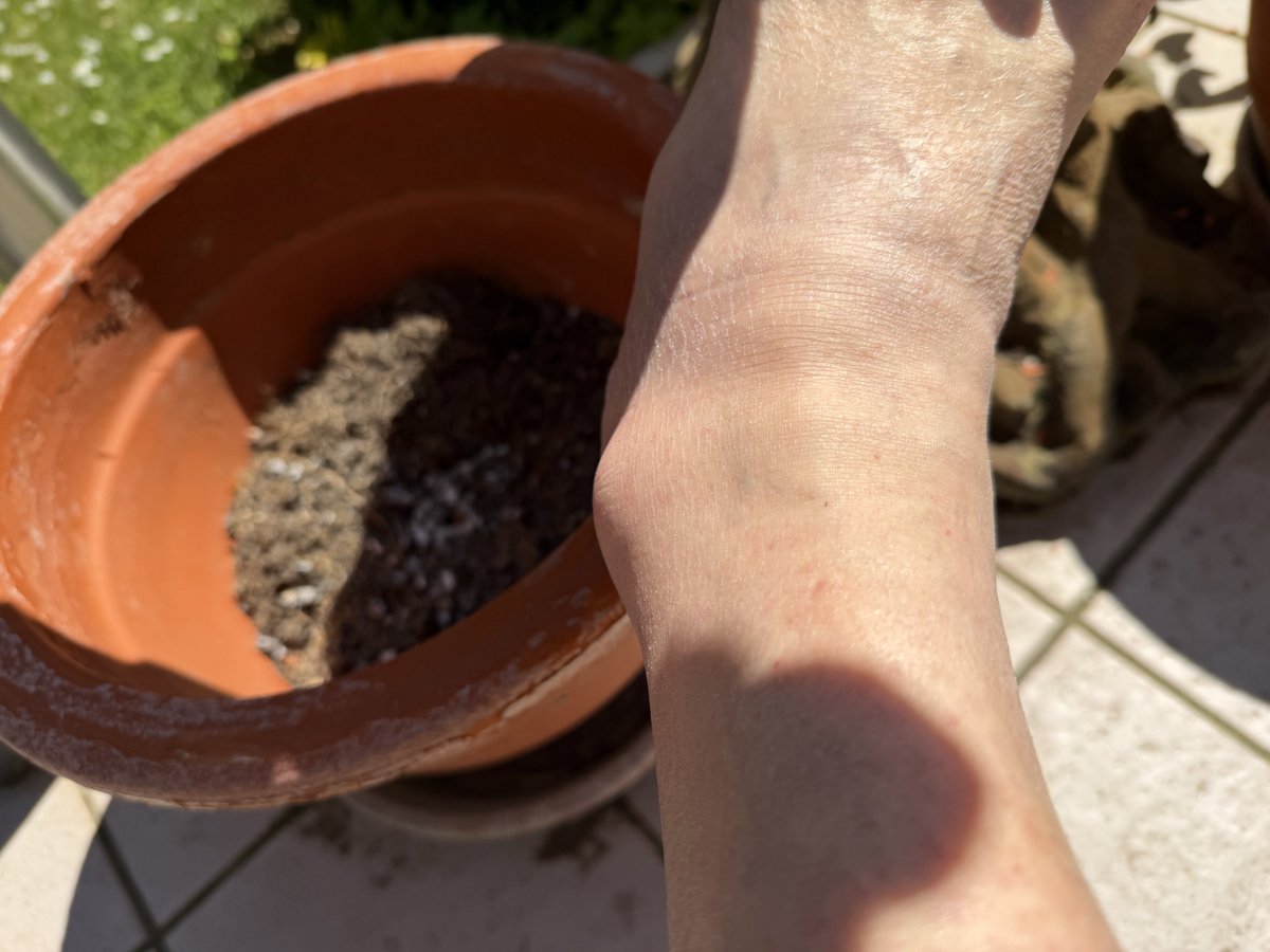 Master 🐿️ tweet media