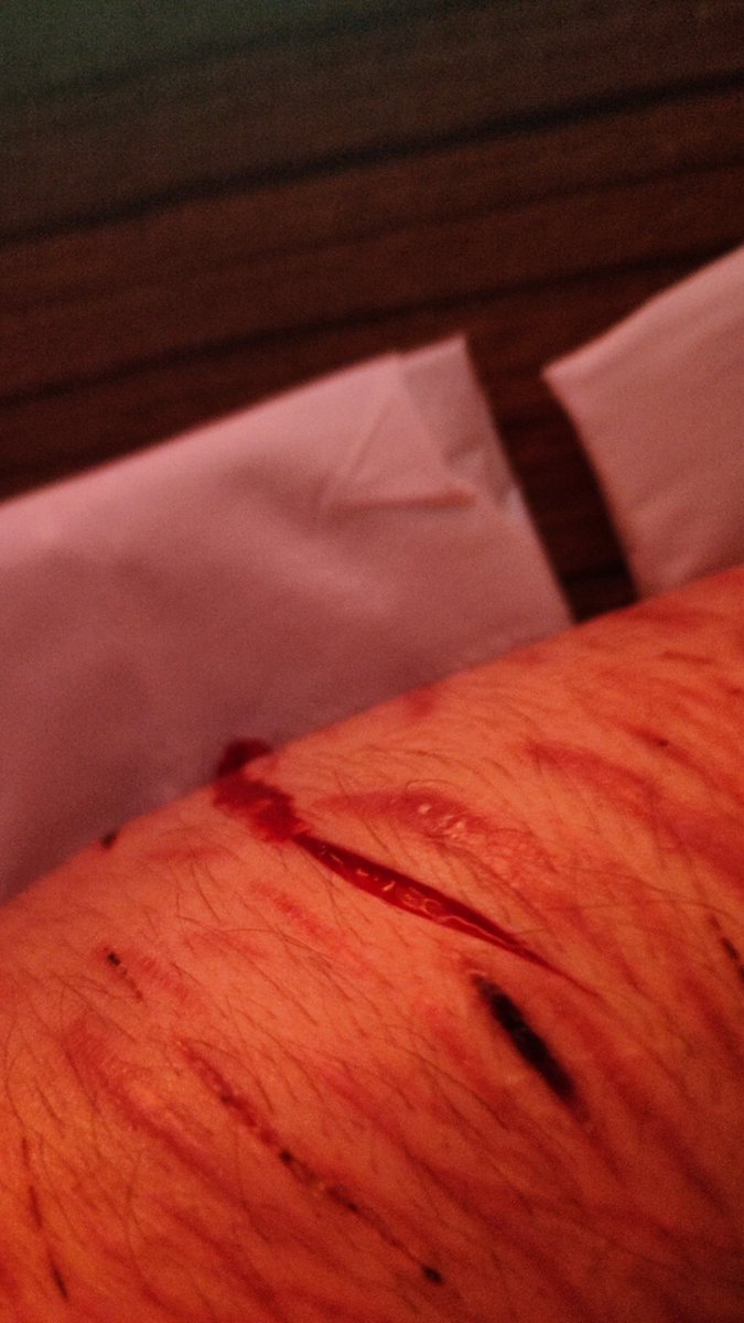 cutting soup - OLD ACCOUNT SUSPENDED tweet media