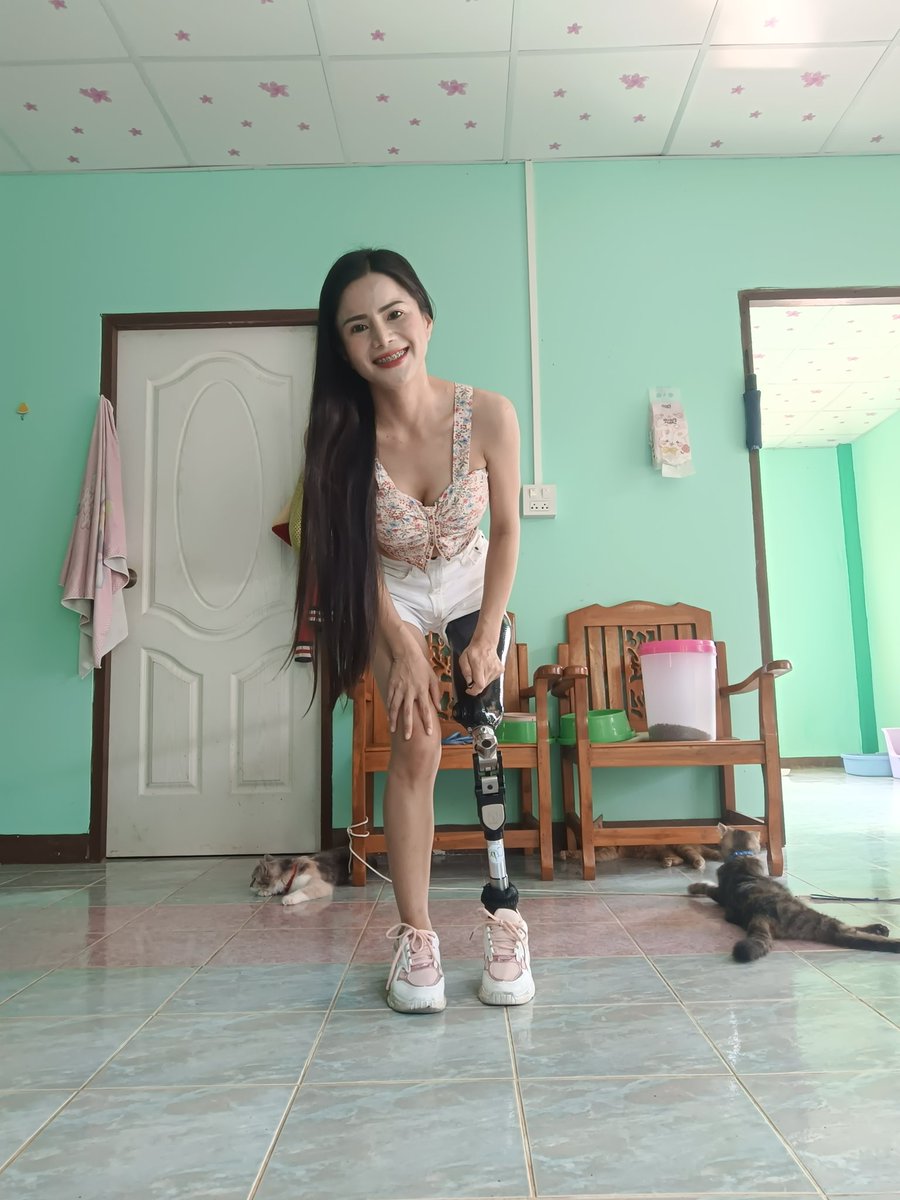 omam_atikan's tweet photo. โลกอาจไม่ง่าย แต่ฉันก็ไม่เคยยอมแพ้ 🙂🙂 #ขาเทียมเพื่อนซี้ https://t.co/v6X6SMj81e
