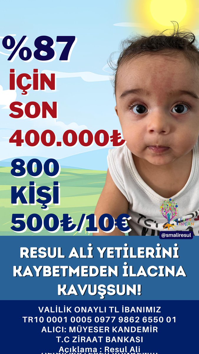 %87 OLMAK İÇİN SON 400.000₺!

Bu artık bir hayal değil,
bitmeye çok yakın bir umut.

Resul Ali’nin sağlığına kavuşması için
sadece son adımı birlikte atmamız gerekiyor.

800 kişi, 500₺ destek…
Ve bu hikâye bugün mutlu biter.

♥️ Az kaldı… Sen de bu mucizenin parçası ol.